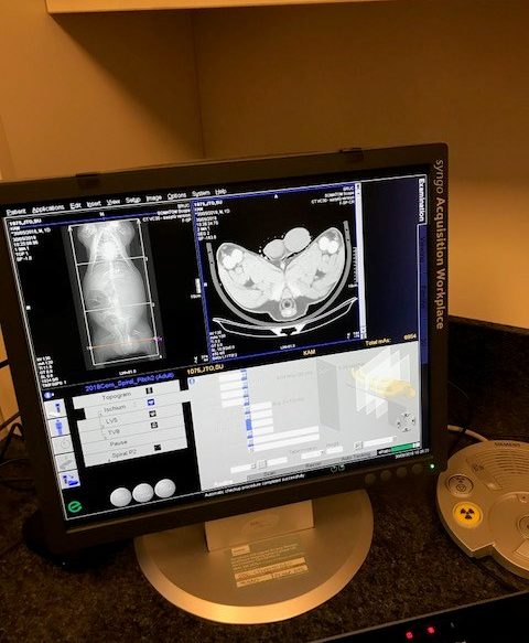 CT Scan screen of a tup torso