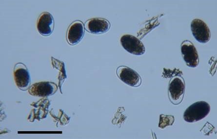 philipskuceGastrointestinal nematode eggs extracted from sheep dung, scale bar 100 micro m Gastrointestinal nematode eggs extracted from sheep dung, scale bar 100 micro m
